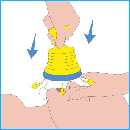 Willnice Anti-Choking Device: Second Step - Push Down Handle