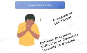 Universal Signs of Choking