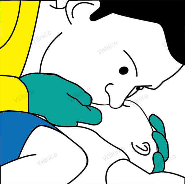 Give 2 quick breaths during CPR for an unresponsive choking infant