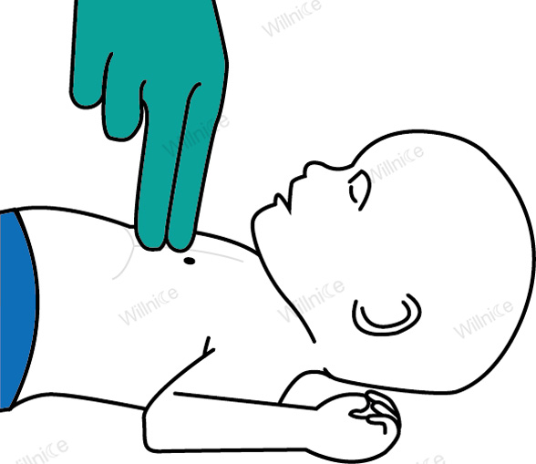 Infant CPR technique: give 30 chest compressions using 2 fingers