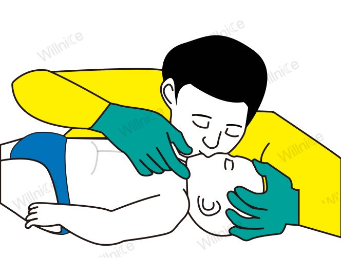 Infant CPR technique: Giving 2 quick breaths to an unresponsive infant