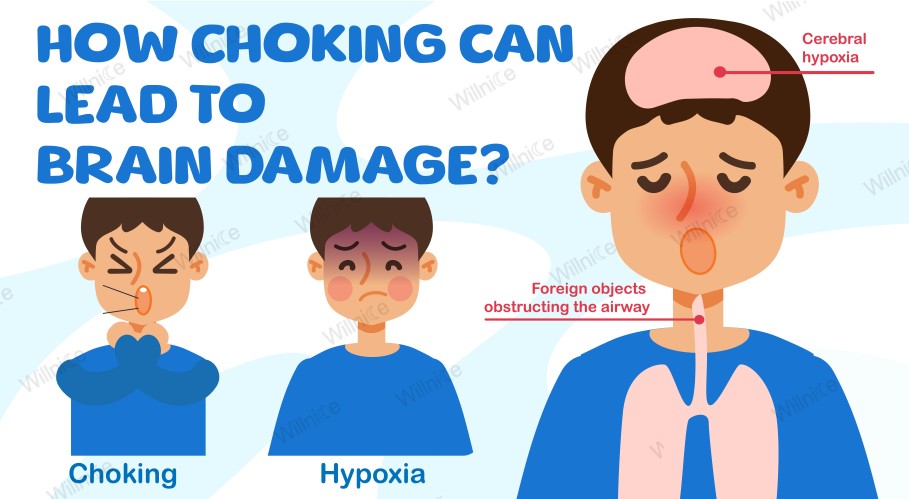 How Choking Can Lead to Brain Damage