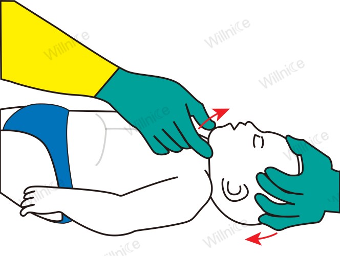 Infant CPR: Open airway using the head-tilt-chin-lift technique