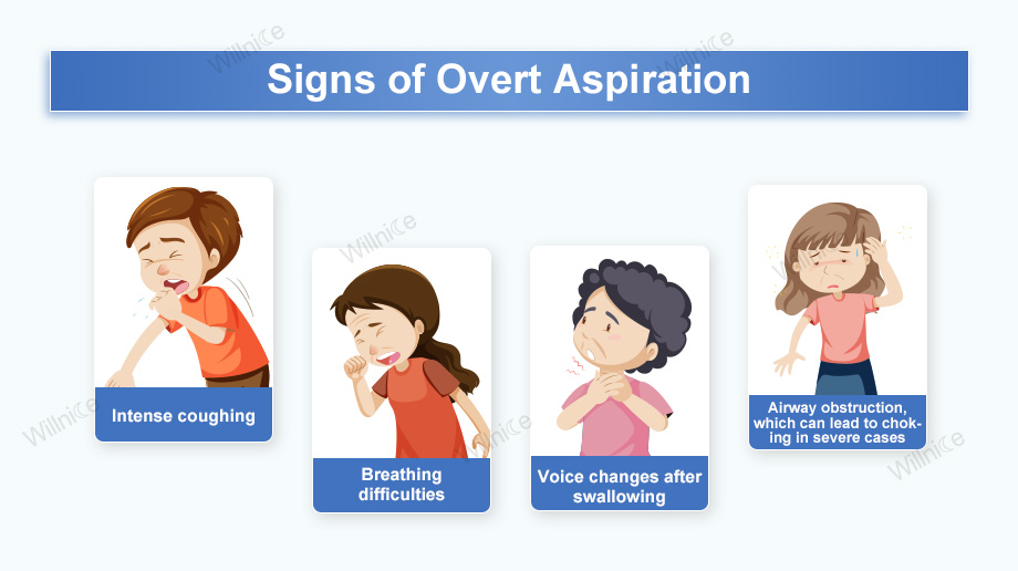 Signs of Overt Aspiration