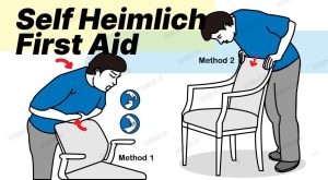 Self Heimlich First Aid: Complete Step-by-Step Guide