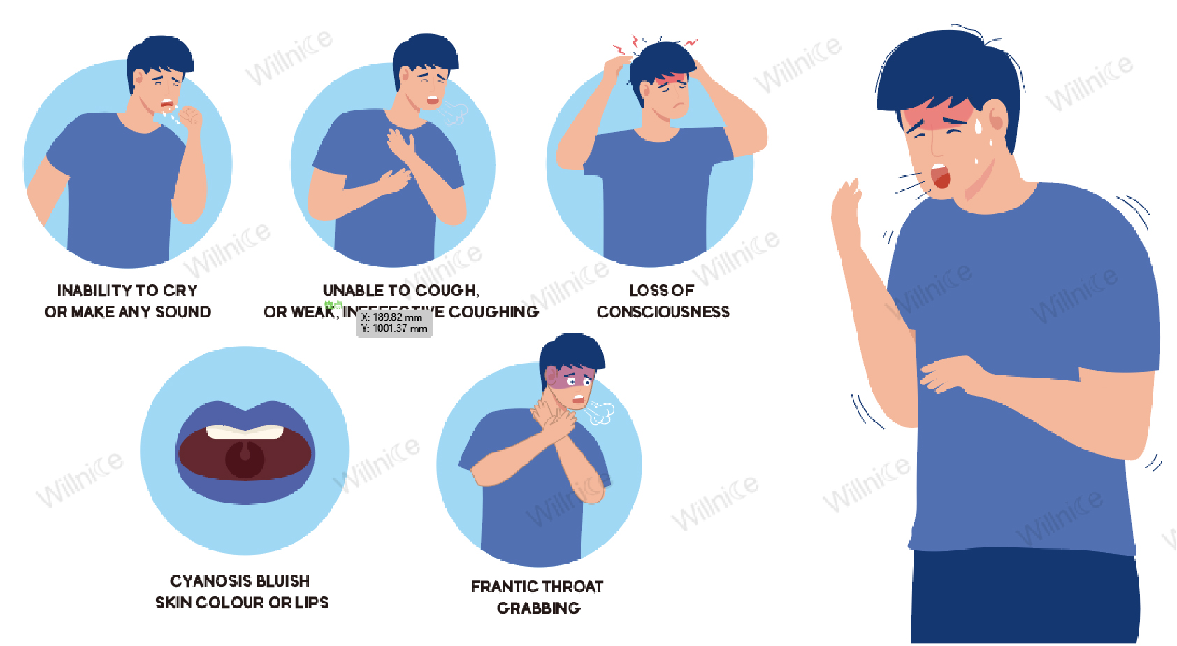 What Causes Choking?Top Hazards, Prevention Tips, First Aid Willnice