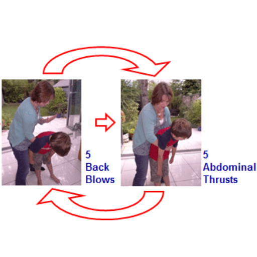 How to Administer First Aid for a Choking Child