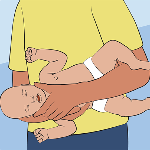 How to Perform First Aid When a Child is Choking