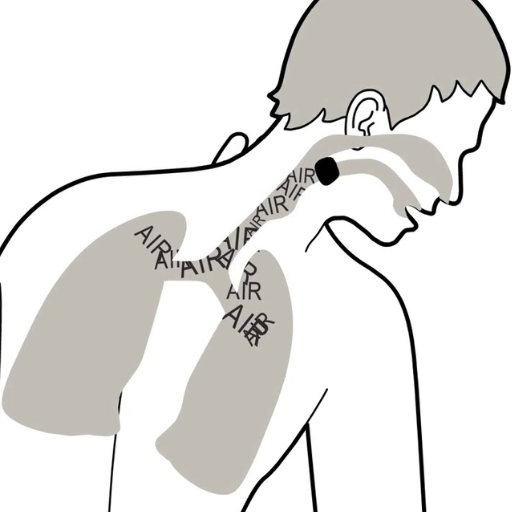 What Are the Signs and Symptoms of Choking (1)