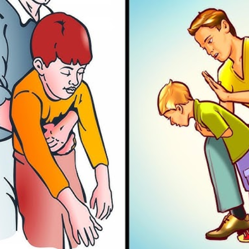 What to Do if the Choking Incident Persists