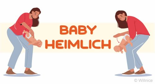 Baby Heimlich, What to Do if a Baby Is Choking [Full Guide]