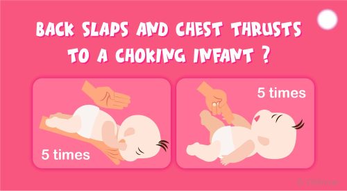 How Many Back Slaps and Chest Thrusts to a Choking Infant?