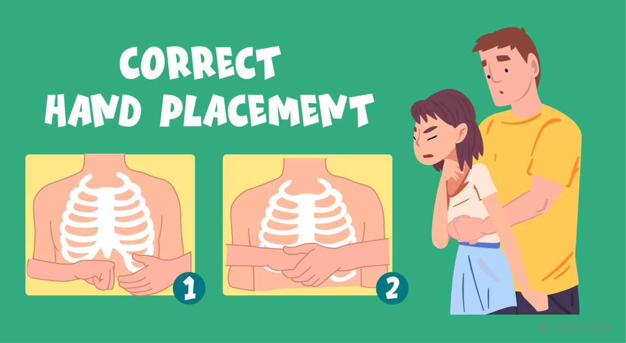 Hand Placement for Abdominal Thrusts on Choking Child