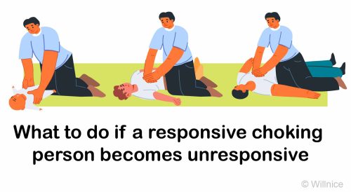 What to do if a Choking Person Becomes Unresponsive – CPR