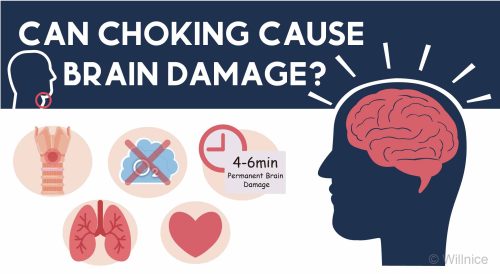 Can Choking Cause Brain Damage? Find Out Here!