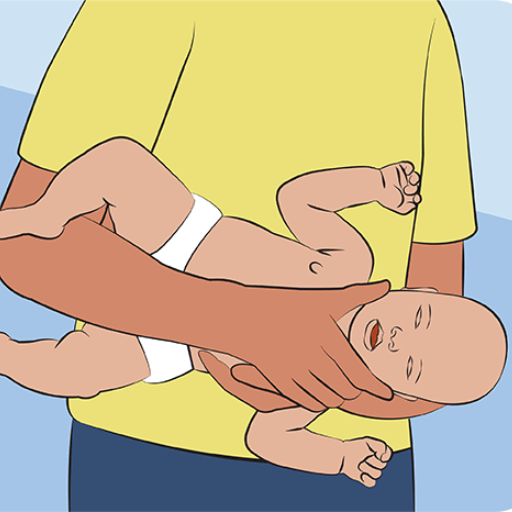 What Resources Are Available for Choking First Aid?