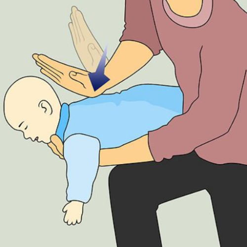 Emergency Guide: How to Help a Choking 1-Year-Old Child