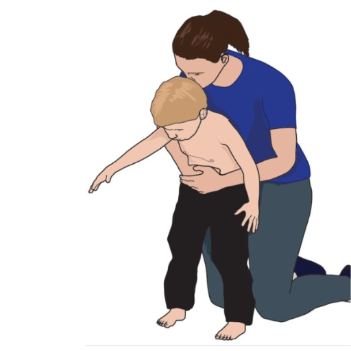 How to help a choking 4-year-old?