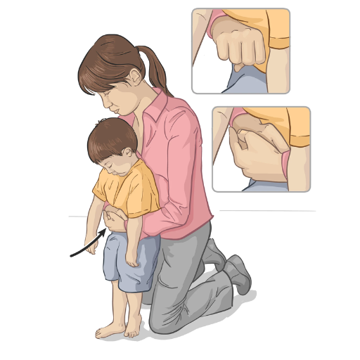 How to Perform CPR if the Infant Becomes Unresponsive?