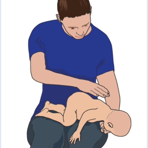 Infant Choking: Essential First Aid and CPR for a Responsive Infant