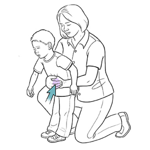 What is the first step in helping a choking two-year-old?