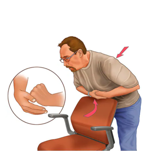 Image showcasing Life-Saving First Aid: What to Do When Someone is Choking - Willnice