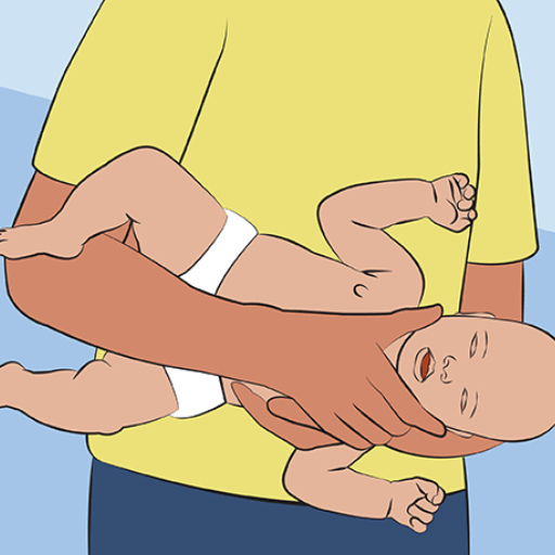 How to Recognize When an Infant is Choking?