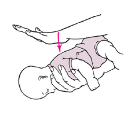 What to Do if the Infant Becomes Unresponsive?