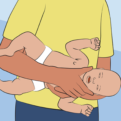 How can you clear the airway of a choking infant?