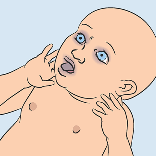 How to care for a responsive choking infant?