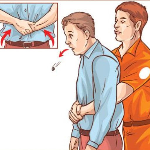 What Should You Do in Case of a Choking Incident?