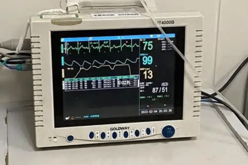 What Does a Chest Compression Feedback Device Monitor?