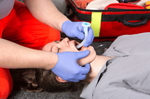 Inserting Oropharyngeal and Nasopharyngeal Airways
