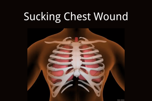 Sucking Chest Wound: First Aid and Management