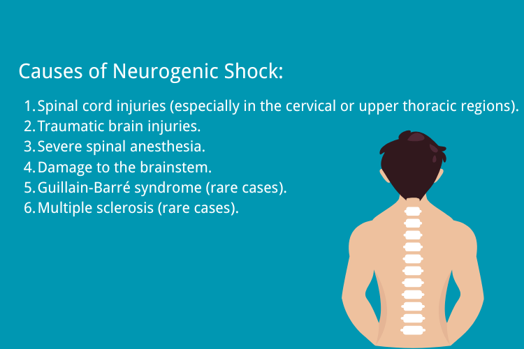 Causes of Neurogenic Shock: