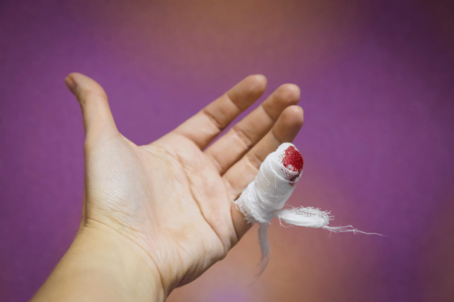 Hemorrhage and Bleed: Causes, Symptoms, and Types Explained