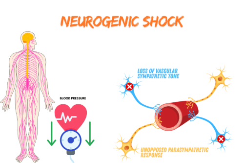 Neurogenic Shock vs. Spinal Shock: Key Differences & Overview