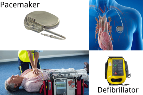 Pacemaker and Defibrillator: What’s the Difference?