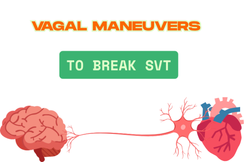 Vagal Maneuvers: Valsalva Maneuver for Supraventricular Tachycardia