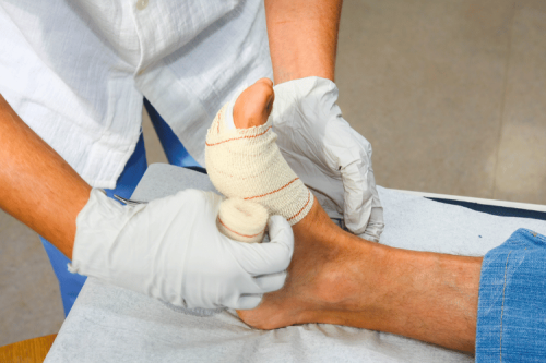 Avulsion Injuries: Skin Avulsion, Wounds, and Treatment
