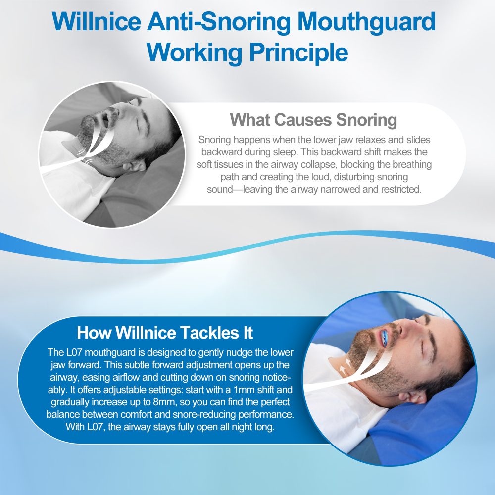 willnice anti snoring mouthpiece working principle